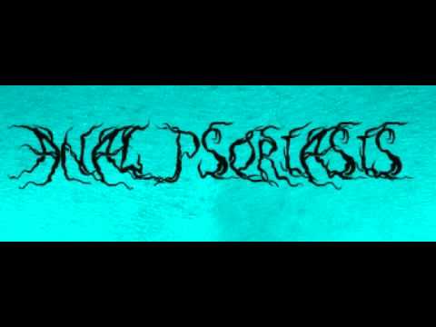 Anal Psoriasis Demo