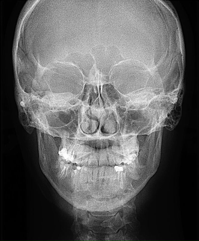 Евгений Виноградов 