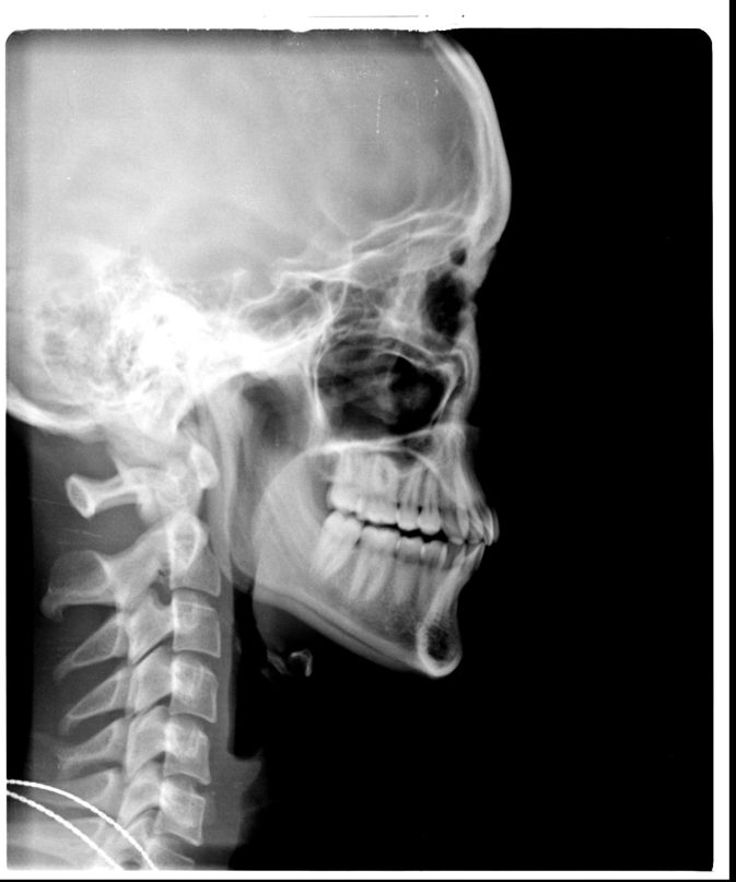 Владислав Вацек Ыштук | Москва