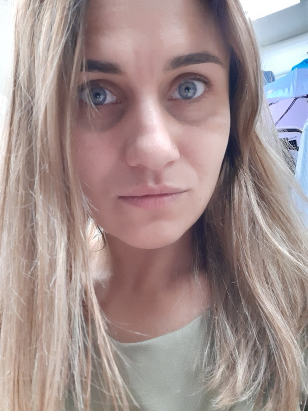 Алёна Плеханова | Топки