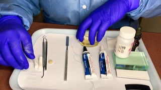 Cementing a Temporary Crown with Temp Bond (Temporary Cement)