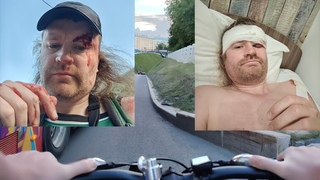 ЖЕСТКО УПАЛ С ВЕЛОСИПЕДА